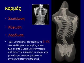 κορμός
• Σκολίωση

• Κύφωση

• Λόρδωση
• Έχει υπολογιστεί ότι περίπου το 2-4%
  του πληθυσμού παγκοσμίως και σε
  ηλικίες από 9 μέχρι 18 ετών πάσχει
  από αυτές τις παθήσεις, οι οποίες στο
  μεγαλύτερο ποσοστό μπορούν να
  αντιμετωπιστούν συντηρητικά
 