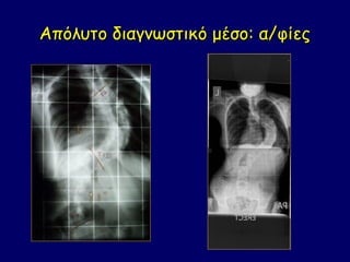 Απόλυτο διαγνωστικό μέσο: α/φίες
 