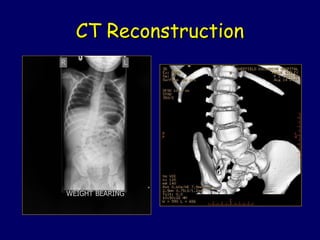 CT Reconstruction
 