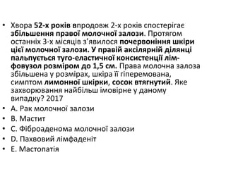 • Хвора 52-х рокiв впродовж 2-х рокiв спостерiгає
збiльшення правої молочної залози. Протягом
останнiх 3-х мiсяцiв з’явилося почервонiння шкiри
цiєї молочної залози. У правiй аксiлярнiй дiлянцi
пальпується туго-еластичної консистенцiї лiм-
фовузол розмiром до 1,5 см. Права молочна залоза
збiльшена у розмiрах, шкiра її гiперемована,
симптом лимонної шкiрки, сосок втягнутий. Яке
захворювання найбiльш iмовiрне у даному
випадку? 2017
• A. Рак молочної залози
• B. Мастит
• C. Фiброаденома молочної залози
• D. Пахвовий лiмфаденiт
• E. Мастопатiя
 