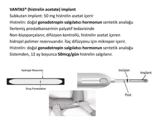 VANTAS® (histrelin acetate) implant
Subkutan implant: 50 mg histrelin asetat içerir
Histrelin: doğal gonadotropin salgılatıcı hormonun sentetik analoğu
İlerlemiş prostatkanserinin palyatif tedavisinde
Non-biyoparçalanır, difüzyon kontrollü, histrelin asetat içeren
hidrojel polimer rezervuarıdır. İlaç difüzyonu için mikropor içerir.
Histrelin: doğal gonadotropin salgılatıcı hormonun sentetik analoğu
Sistemden, 12 ay boyunca 50mcg/gün histrelin salgılanır.
 