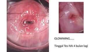 GLOWWING……
Tinggal Tes IVA 4 bulan lagi
 