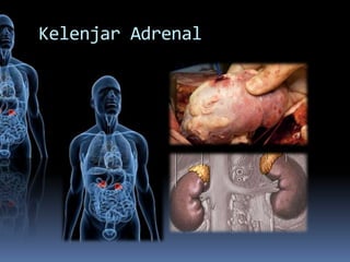 Kelenjar Adrenal
 