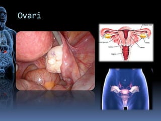 Ovari
 