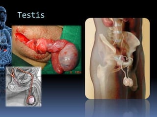 Testis
 