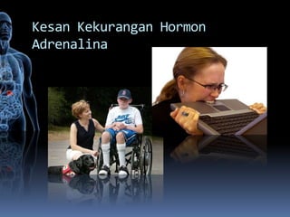Kesan Kekurangan Hormon
Adrenalina
 