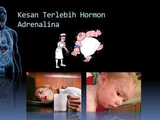 Kesan Terlebih Hormon
Adrenalina
 