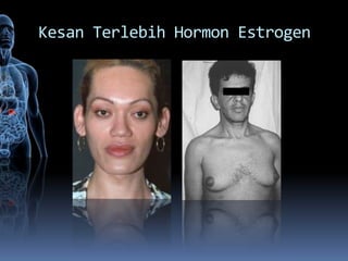 Kesan Terlebih Hormon Estrogen
 