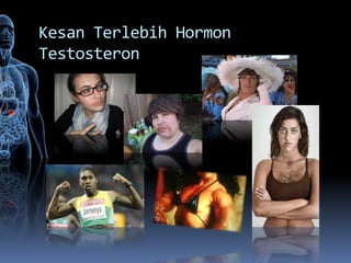 Kesan Terlebih Hormon
Testosteron
 