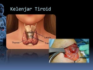 Kelenjar Tiroid
 