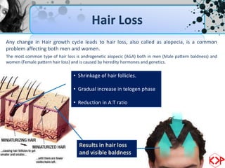 Hair Loss
Any change in Hair growth cycle leads to hair loss, also called as alopecia, is a common
problem affecting both men and women.
The most common type of hair loss is androgenetic alopecic (AGA) both in men (Male pattern baldness) and
women (Female pattern hair loss) and is caused by heredity hormones and genetics.

                                 • Shrinkage of hair follicles.

                                 • Gradual increase in telogen phase

                                 • Reduction in A:T ratio




                                    Results in hair loss
                                    and visible baldness
 