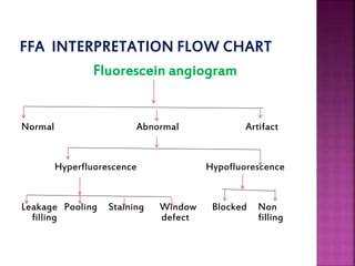 Fluorescein angiogram
Normal Abnormal Artifact
Hyperfluorescence Hypofluorescence
Leakage Pooling Staining Window Blocked Non
filling defect filling
 