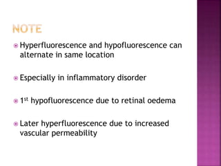  Hyperfluorescence and hypofluorescence can
alternate in same location
 Especially in inflammatory disorder
 1st hypofluorescence due to retinal oedema
 Later hyperfluorescence due to increased
vascular permeability
 