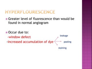  Greater level of fluorescence than would be
found in normal angiogram
 Occur due to:
-window defect
-increased accumulation of dye
leakage
pooling
staining
 