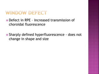  Defect in RPE – increased transmission of
choroidal fluorescence
 Sharply defined hyperfluorescence - does not
change in shape and size
 