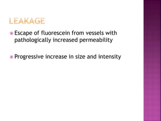  Escape of fluorescein from vessels with
pathologically increased permeability
 Progressive increase in size and intensity
 