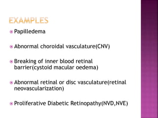  Papilledema
 Abnormal choroidal vasculature(CNV)
 Breaking of inner blood retinal
barrier(cystoid macular oedema)
 Abnormal retinal or disc vasculature(retinal
neovascularization)
 Proliferative Diabetic Retinopathy(NVD,NVE)
 