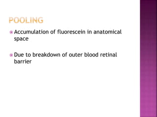  Accumulation of fluorescein in anatomical
space
 Due to breakdown of outer blood retinal
barrier
 