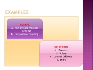 RETINAL
a. non-cystoid macular
oedema
b. Perivascular staining
SUB RETINAL
a. Drusens
b. Sclera
c. Lamina cribrosa
d. scars
 