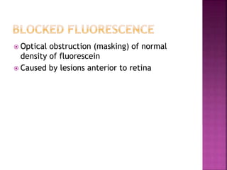  Optical obstruction (masking) of normal
density of fluorescein
 Caused by lesions anterior to retina
 