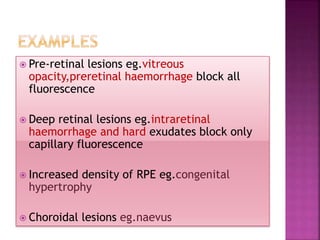  Pre-retinal lesions eg.vitreous
opacity,preretinal haemorrhage block all
fluorescence
 Deep retinal lesions eg.intraretinal
haemorrhage and hard exudates block only
capillary fluorescence
 Increased density of RPE eg.congenital
hypertrophy
 Choroidal lesions eg.naevus
 