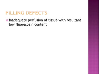  Inadequate perfusion of tissue with resultant
low fluorescein content
 