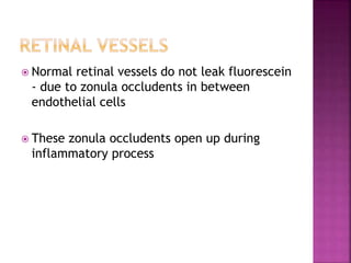  Normal retinal vessels do not leak fluorescein
- due to zonula occludents in between
endothelial cells
 These zonula occludents open up during
inflammatory process
 