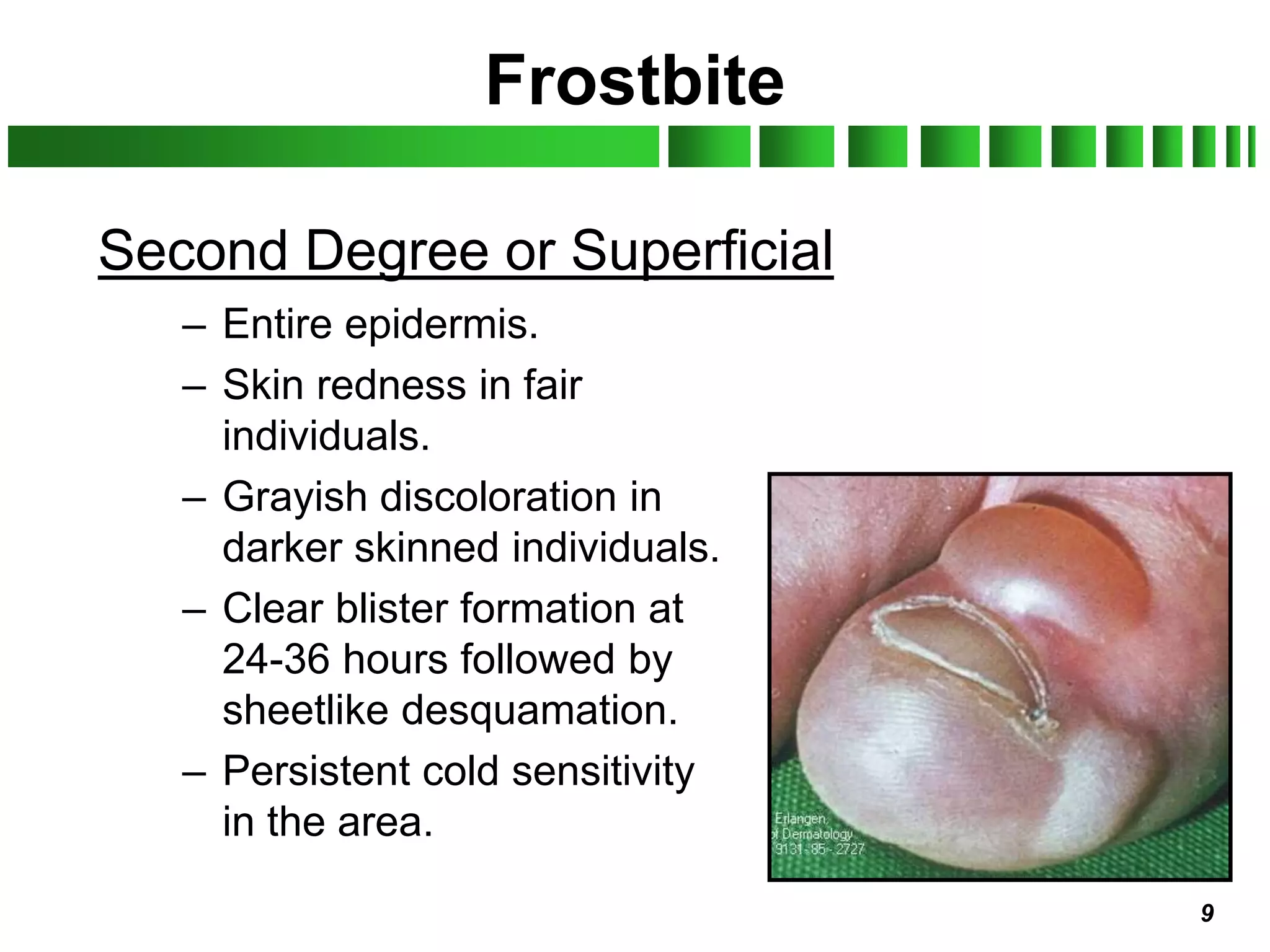 Frostbite Examples Korea_Soldiers_Guide_to_Prevent_Cold_Weather_Injuries.ppt