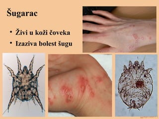 Šugarac

Živi u koži čoveka

Izaziva bolest šugu
 