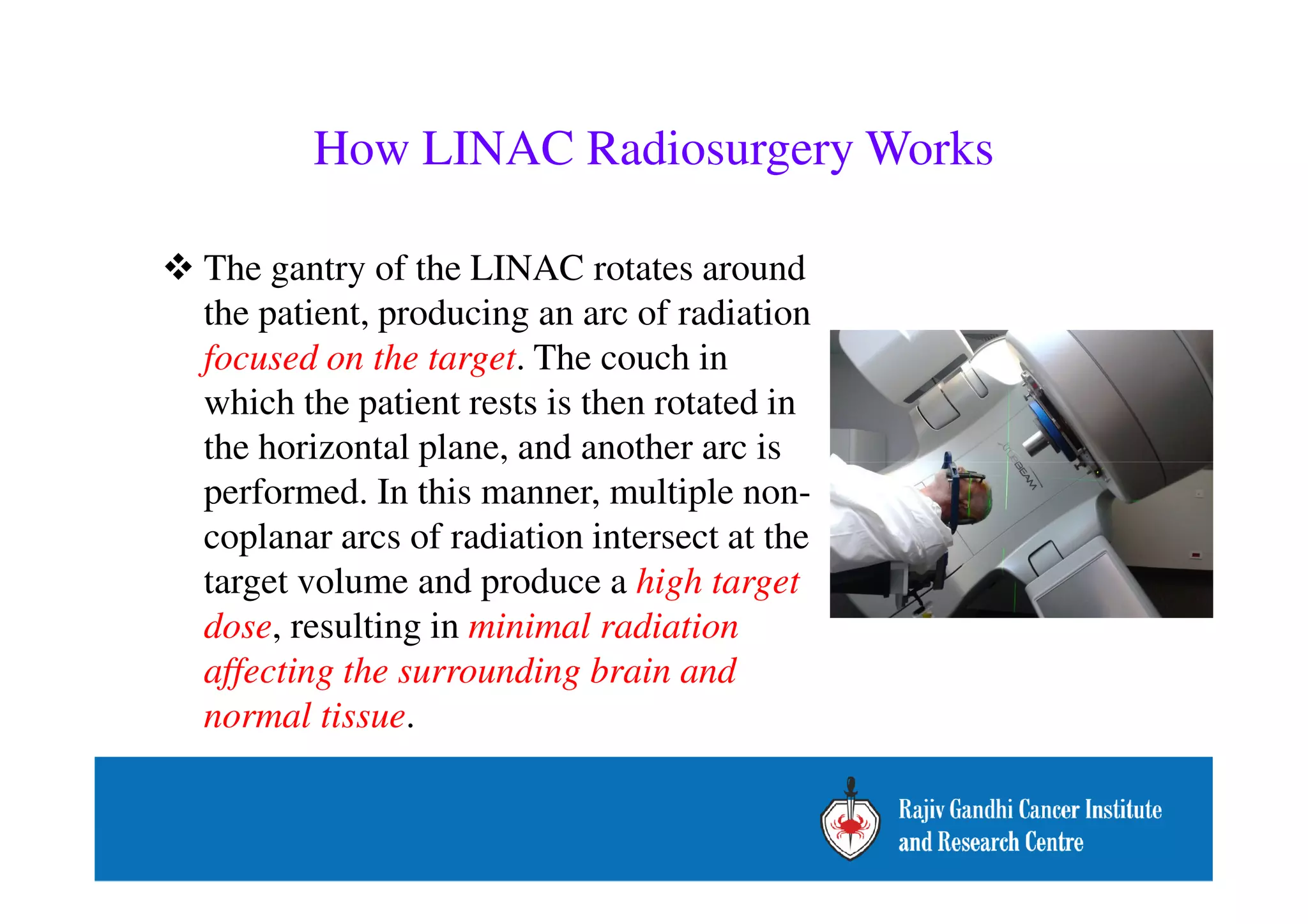 How LINAC Radiosurgery Works 
 The gantry of the LINAC rotates around 
the patient, producing an arc of radiation 
focused on the target. The couch in 
which the patient rests is then rotated in 
the horizontal plane, and another arc is 
performed. In this manner, multiple non-coplanar 
arcs of radiation intersect at the 
target volume and produce a high target 
dose, resulting in minimal radiation 
affecting the surrounding brain and 
normal tissue. 
 