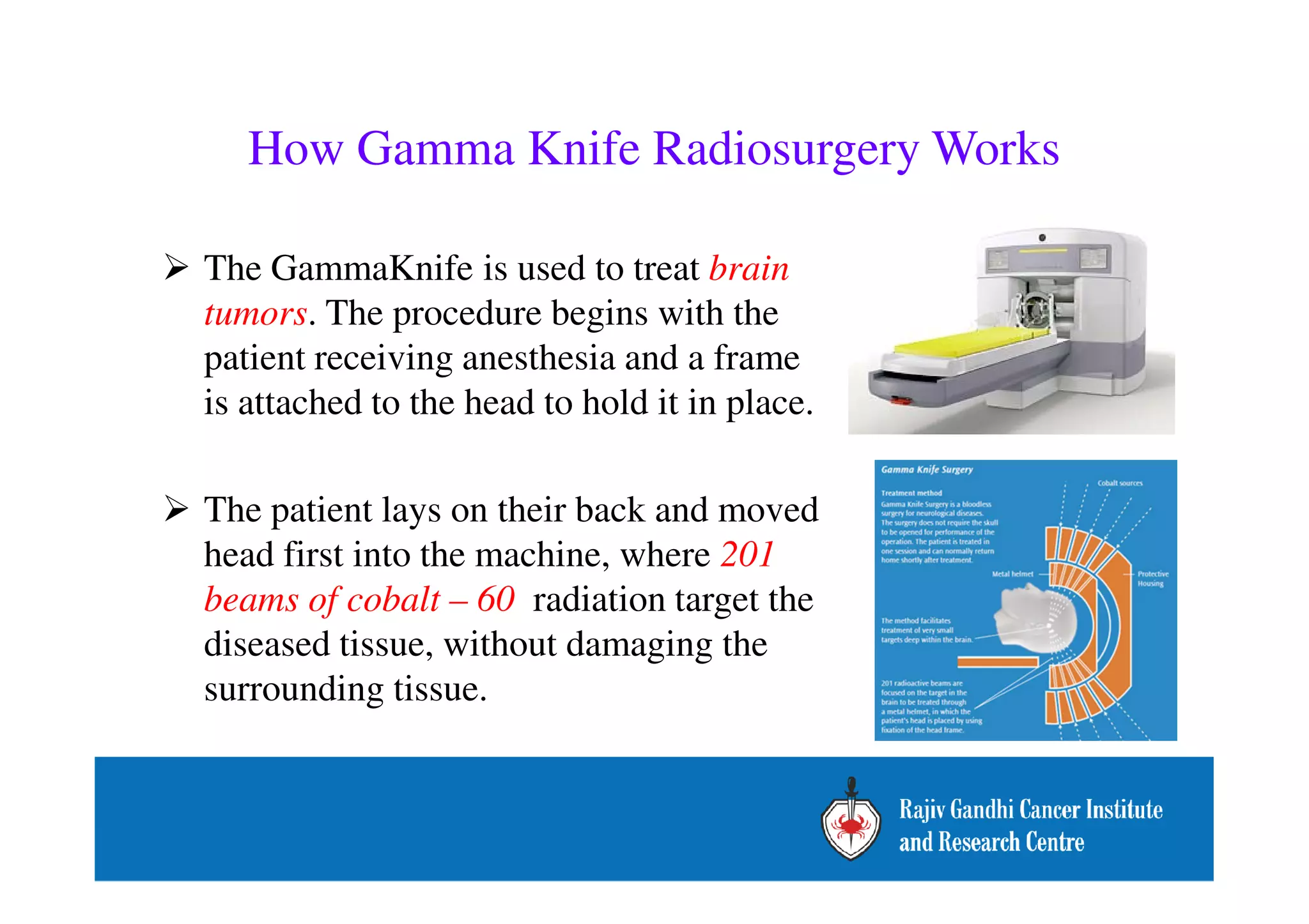 How Gamma Knife Radiosurgery Works 
 The GammaKnife is used to treat brain 
tumors. The procedure begins with the 
patient receiving anesthesia and a frame 
is attached to the head to hold it in place. 
 The patient lays on their back and moved 
head first into the machine, where 201 
beams of cobalt – 60 radiation target the 
diseased tissue, without damaging the 
surrounding tissue. 
 