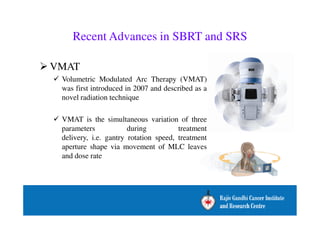Recent Advances in SBRT and SRS 
VMAT 
 Volumetric Modulated Arc Therapy (VMAT) 
was first introduced in 2007 and described as a 
novel radiation technique 
 VMAT is the simultaneous variation of three 
parameters during treatment 
delivery, i.e. gantry rotation speed, treatment 
aperture shape via movement of MLC leaves 
and dose rate 
 