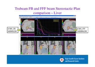 Trubeam FB and FFF beam Stereotactic Plan 
comparison – Liver 
6 MV_FFF 
1400MU/M 
6 MV_FB 
600MU/M 
 