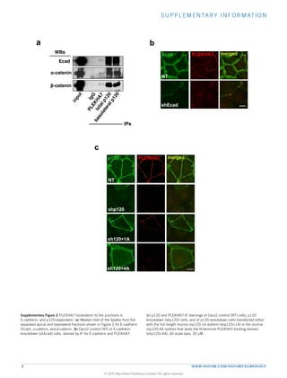 SUPPLEMENTARY INFORMATION
2 WWW.NATURE.COM/NATURECELLBIOLOGY
Supplementary Figure 2
NT
PLEKHA7Ecad merged
shEcad
NT
PLEKHA7p120 merged
sh120+1A
shp120
sh120+4A
c
b
WBs
α-catenin
IPs
Ecad
β-catenin
a
Supplementary Figure 2 PLEKHA7 localization to the junctions is
E-cadherin- and p120-dependent. (a) Western blot of the lysates from the
separated apical and basolateral fractions shown in Figure 2 for E-cadherin
(Ecad), α-catenin, and β-catenin. (b) Caco2 control (NT) or E-cadherin
knockdown (shEcad) cells, stained by IF for E-cadherin and PLEKHA7.
(c) p120 and PLEKHA7 IF stainings of Caco2 control (NT) cells, p120
knockdown (shp120) cells, and of p120 knockdown cells transfected either
with the full length murine mp120-1A isoform (shp120+1A) or the murine
mp120-4A isoform that lacks the N-terminal PLEKHA7-binding domain
(shp120+4A). All scale bars: 20 μM.
© 2015 Macmillan Publishers Limited. All rights reserved
 