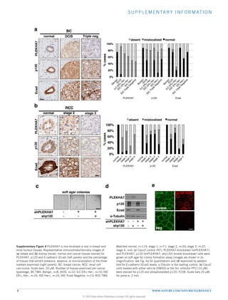 SUPPLEMENTARY INFORMATION
4 WWW.NATURE.COM/NATURECELLBIOLOGY
0%
20%
40%
60%
80%
100%
PLEKHA7 p120 Ecad
%cases
absent mislocalized normal
DCISnormal
stage 2normal
BC
RCC
a
b
p120EcadPLEKHA7 Triple neg.
stage 3
0%
20%
40%
60%
80%
100%
PLEKHA7 p120 Ecad
%cases
absent mislocalized normal
p120EcadPLEKHA7
Supplementary Figure 4
c
shp120
shPLEKHA7
-- +
- + +
soft agar colonies
d
shp120
shPLEKHA7 - -
--
+
+
+
+
α-Tubulin
PLEKHA7
p120
Ecad
p120:Y228p120
PP2
control
e
Supplementary Figure 4 PLEKHA7 is mis-localized or lost in breast and
renal tumour tissues. Representative immunohistochemistry images of
(a) breast and (b) kidney (renal), normal and cancer tissues stained for
PLEKHA7, p120 and E-cadherin (Ecad) (left panels) and the percentage
of tissues that exhibit presence, absence, or mis-localization of the three
markers examined (right panels). BC: breast cancer; RCC: renal cell
carcinoma. Scale bars: 20 μM. Number of tissues examined per cancer
type/stage; BC TMA: Benign, n=8; DCIS, n=12; ILC ER+ Her-, n=10; IDC
ER+, Her-, n=16; IDC Her+, n=16; IDC Triple Negative, n=13; RCC TMA:
Matched normal, n=119; stage 1, n=71; stage 2, n=20; stage 3, n=22;
stage 4, n=6. (c) Caco2 control (NT), PLEKHA7 knockdown (shPLEKHA7),
and PLEKHA7, p120 (shPLEKHA7, shp120) double knockdown cells were
grown on soft agar for colony formation assay (images are shown in 2x
magnification; see Fig. 4a for quantitation) and (d) examined by western
blot for E-cadherin (Ecad) levels; α-Tubulin is the loading control. (e) Caco2
cells treated with either vehicle (DMSO) or the Src inhibitor PP2 (10 μM)
were stained for p120 and phosphorylated p120: Y228. Scale bars 20 μM;
for panel c: 2 mm.
© 2015 Macmillan Publishers Limited. All rights reserved
 
