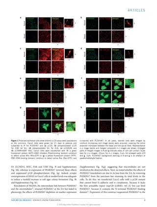 ARTICLES
p190PLEKHA7 Merged
x
Mergedp120PLEKHA7
y
x
z
x
x
z
p120: Tyr228PLEKHA7
SrcPLEKHA7 Src: Tyr 416PLEKHA7
ApicalBasal
x
x
y
x
y
p130CASPLEKHA7
ApicalBasal
x
y
x
z
Apical
a b
c d
e f
g h
Basal
MergedPLEKHA7 Rho-GTP
y
Merged
Merged
Merged
x
y
Merged
z
x
x
z
y
x
MergedPLEKHA7
ApicalBasal
Rac-GTP
x
y
z
ApicalBasalApicalBasalApicalBasalBasalApical
Figure 1 Polarized epithelial cells show distinct p120-associated populations
at the junctions. Caco2 cells were grown for 21 days to polarize and
subjected to IF for PLEKHA7 and (a) p120, (b) phosphorylated p120
Tyr 228, (c) Src, (d) phosphorylated Src Tyr 416; (e) p130CAS and
(h) p190RhoGAP. Also, Caco2 cells were transfected with (f) a green
ﬂuorescent protein (GFP)–rGBD (rhotekin RhoA-binding domain) construct
to detect active Rho (Rho-GTP) or (g) a yellow ﬂuorescent protein (YFP)–
PBD (PAK-binding domain) construct to detect active Rac (Rac-GTP), and
co-stained with PLEKHA7. In all cases, stained cells were imaged by
confocal microscopy and image stacks were acquired, covering the entire
polarized monolayer between the basal and the apical level. Representative
x–y image stacks and merged composite x–z images are shown. Enlarged
parts of merged images in f and g indicate areas of cell–cell contact. Scale
bars for x–y images, 20 µm; for x–z images, 5 µm; for enlarged parts of f
and g, 3 µm. PLEKHA7 background staining in f and g is an artefact of
paraformaldehyde ﬁxation.
D1 (CCND1), MYC, FAK and VIM (Fig. 3f and Supplementary
Fig. 3d), whereas re-expression of PLEKHA7 reversed these eﬀects
and suppressed p120 phosphorylation (Fig. 3g). Indeed, ectopic
overexpression of SNAI1 in Caco2 cells at modest levels was adequate
to induce a twofold increase in soft agar colony formation (Fig. 3h
and Supplementary Fig. 3e).
Knockdown of NEZHA, the intermediate link between PLEKHA7
and the microtubules21
, retained PLEKHA7 at the ZA but failed to
phenocopy the eﬀects of PLEKHA7 depletion on marker expression
(Supplementary Fig. 3f,g), suggesting that microtubules are not
involved in the observed eﬀects. Next, we tested whether the eﬀects of
PLEKHA7 knockdown are due to its loss from the ZA, by removing
PLEKHA7 from the junctions but retaining its total levels in the
cells. To do this, we transfected Caco2 cells with a p120 mutant
that cannot bind E-cadherin and is cytoplasmic, because it lacks
the first armadillo repeat (mp120- ARM1; ref. 2), but can bind
PLEKHA7, because it contains the N-terminal PLEKHA7-binding
domain21
. Expression of this construct sequestered PLEKHA7 to the
NATURE CELL BIOLOGY ADVANCE ONLINE PUBLICATION 3
© 2015 Macmillan Publishers Limited. All rights reserved
 