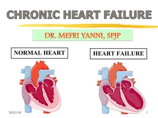 NORMAL HEART HEART FAILURE
03/21/18 1
 