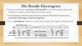 Basics of His bundle Electrogram.pptx