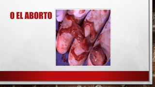 O EL ABORTO