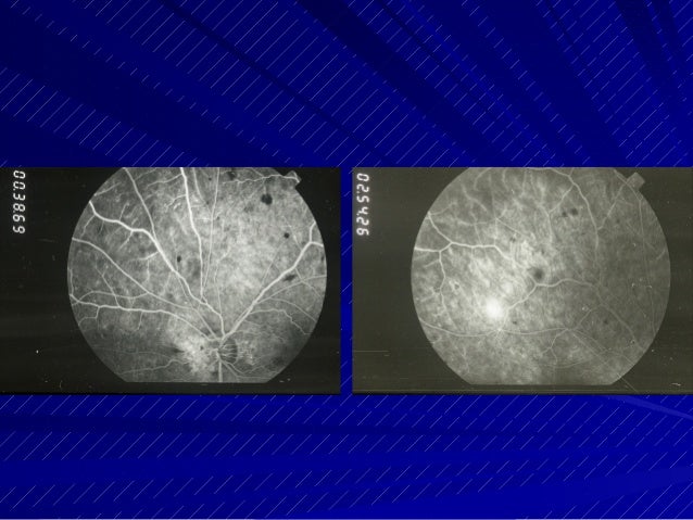 SEARCH AND BUY THIS PRODUCT Kranias diagnostic challenges in retinal diseases 06 20 14