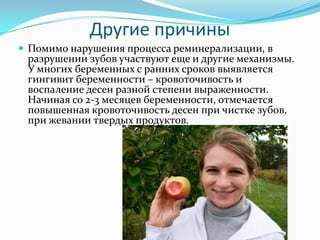 Другие причины
 Помимо нарушения процесса реминерализации, в
разрушении зубов участвуют еще и другие механизмы.
У многих беременных с ранних сроков выявляется
гингивит беременности – кровоточивость и
воспаление десен разной степени выраженности.
Начиная со 2-3 месяцев беременности, отмечается
повышенная кровоточивость десен при чистке зубов,
при жевании твердых продуктов.
 