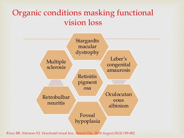 Functional vision loss differentiating functional vision loss from