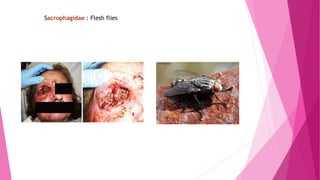 Sacrophagidae : Flesh flies
 