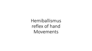 Hemiballismus
reflex of hand
Movements
 