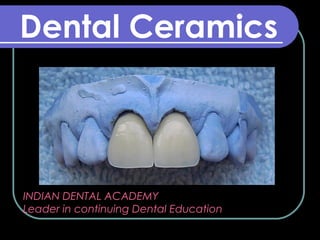 Dental Ceramics
INDIAN DENTAL ACADEMY
Leader in continuing Dental Education
www.indiandentalacademy.com
 