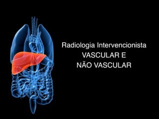 TextoR
Radiologia Intervencionista
VASCULAR E
NÃO VASCULAR
 