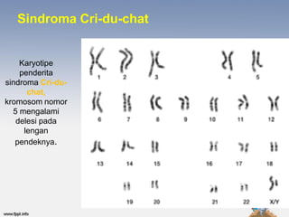 Sindroma Cri-du-chat


    Karyotipe
    penderita
sindroma Cri-du-
      chat,
kromosom nomor
  5 mengalami
   delesi pada
     lengan
   pendeknya.
 