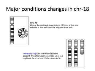 Major conditions changes in chr-18 Ring 18 One of the copies of chromosome 18 forms a ring, and material is lost from both the long and short arm. Tetrasomy 18p An extra chromosome is present. This chromosome is made up of two copies of the short arm of chromosome 18. 