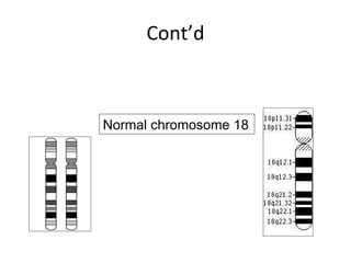 Cont’d Normal chromosome 18 