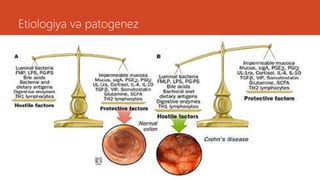 Etiologiya və patogenez
 